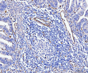 Anti-CD93 Antibody