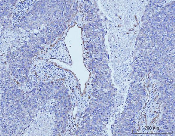 Anti-CD93 Antibody