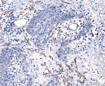 Anti-CD93 Antibody