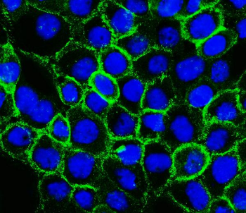 P cadherin/CDH3 Rabbit Polyclonal Antibody