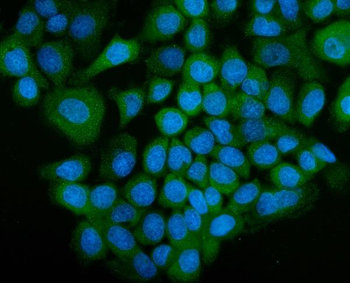 Anti-SGT1/ECD Antibody