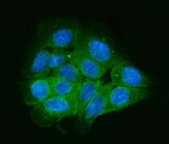 Anti-ENAH/MENA Antibody
