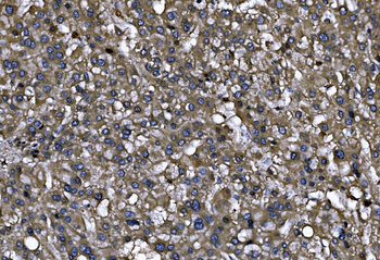 Anti-ENAH/MENA Antibody