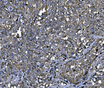 Anti-ENAH/MENA Antibody