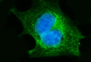 Anti-FGFR3 Antibody