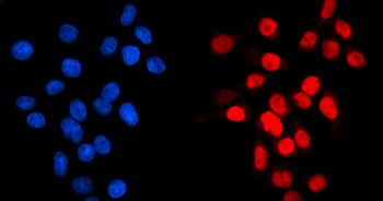 Anti-GATA6 Antibody