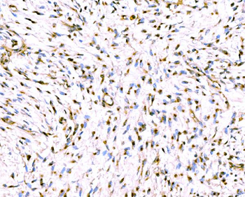 Anti-Giantin/GOLGB1 Antibody