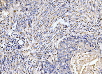 Anti-Giantin/GOLGB1 Antibody