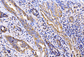 Anti-Giantin/GOLGB1 Antibody