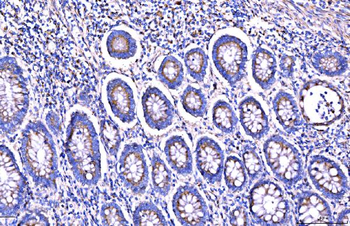 Anti-Giantin/GOLGB1 Antibody