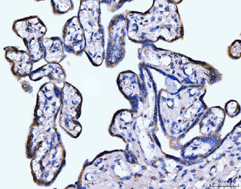 Anti-Giantin/GOLGB1 Antibody