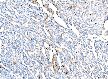 Anti-Hemoglobin/HBA1/HBA2 Antibody