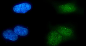 Anti-MSL2 Antibody