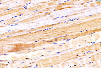 Anti-MYH6 Antibody