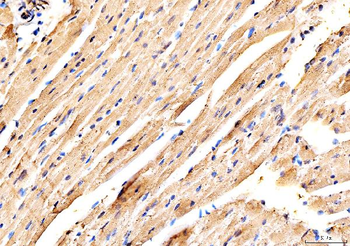 Anti-MYH6 Antibody