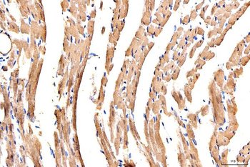 Anti-MYH6 Antibody