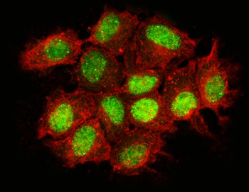 Anti-Nac1/NACC1 Antibody