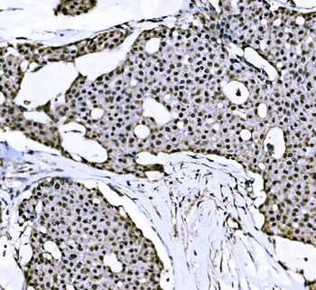Anti-Nac1/NACC1 Antibody