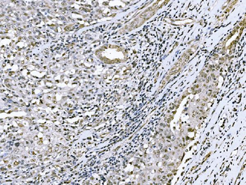 Anti-Nac1/NACC1 Antibody
