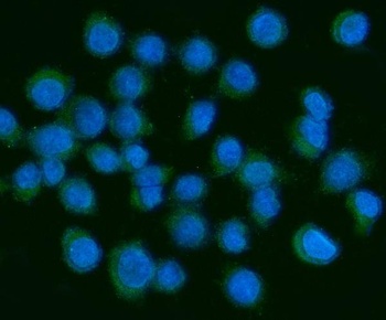 PDGF AA/PDGFA Antibody