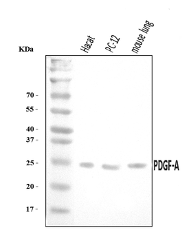 Anti-PDGF AA/PDGFA Antibody