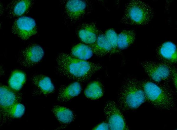Anti-PDP1/PDP Antibody