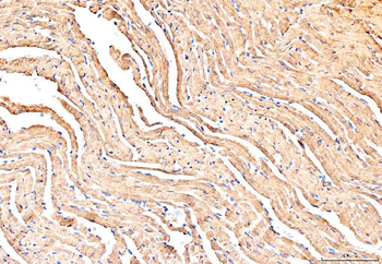 Phospholamban/PLN Antibody