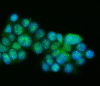 Presenilin 1/PS-1/PSEN1/PS Rabbit Polyclonal Antibody
