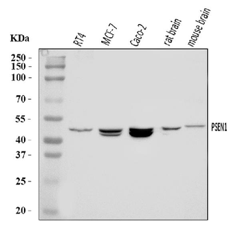 Presenilin 1/PS-1/PSEN1/PS Rabbit Polyclonal Antibody