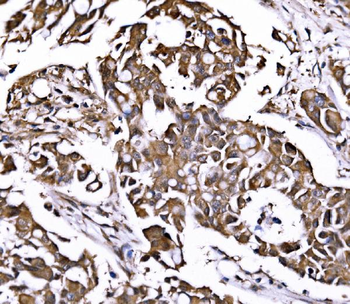 Anti-PSMD8 Antibody