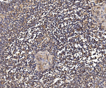 Anti-PSMD8 Antibody