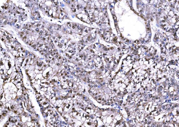 Anti-PSMD8 Antibody