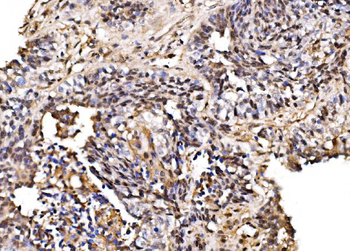 Anti-PSMD8 Antibody
