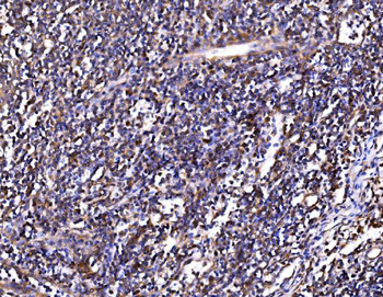 Anti-PSMD8 Antibody