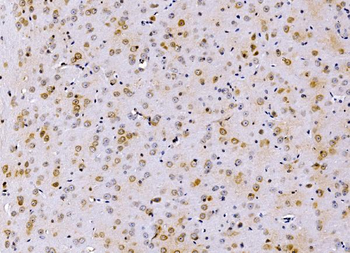 Anti-PSMD8 Antibody