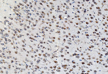 Anti-PSMD8 Antibody