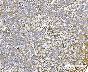 Anti-Poliovirus Receptor/PVR Antibody