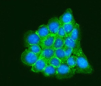 Anti-RPLP0 Antibody
