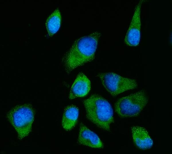 Anti-RPS2 Antibody