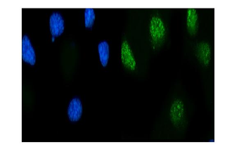 Anti-MSK2/RSK-B/RPS6KA4 Antibody