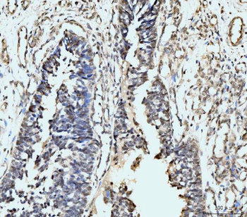 Anti-MSK2/RSK-B/RPS6KA4 Antibody