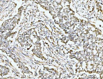 Anti-MSK2/RSK-B/RPS6KA4 Antibody
