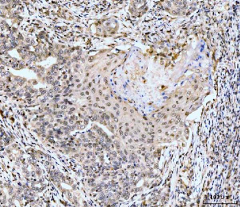 Anti-MSK2/RSK-B/RPS6KA4 Antibody