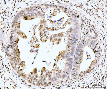 Anti-MSK2/RSK-B/RPS6KA4 Antibody