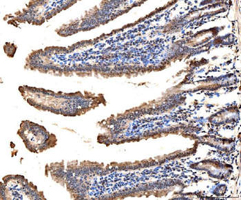 Anti-MSK2/RSK-B/RPS6KA4 Antibody