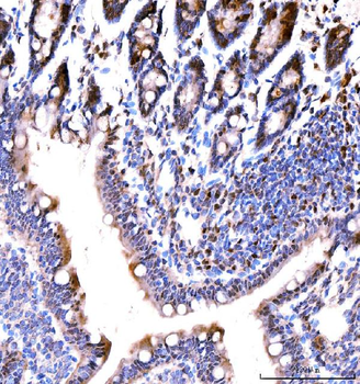 Anti-MSK2/RSK-B/RPS6KA4 Antibody