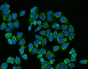 Anti-SREBP2/SREBF2 Antibody