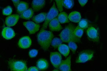 Anti-SRI Antibody