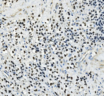 Anti-AP2 gamma/TFAP2C Antibody