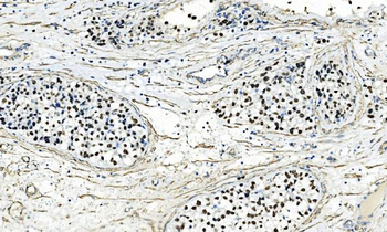 Anti-AP2 gamma/TFAP2C Antibody